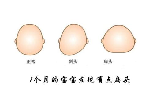 睡平头已坑上亿中国人没有科学道理是陋习别再让宝宝裹脚